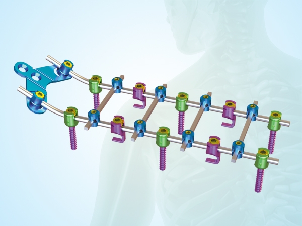 Posterior cervical fixation system
