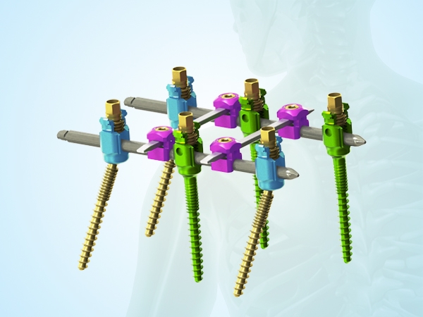 Minimally invasive spinal internal fixation