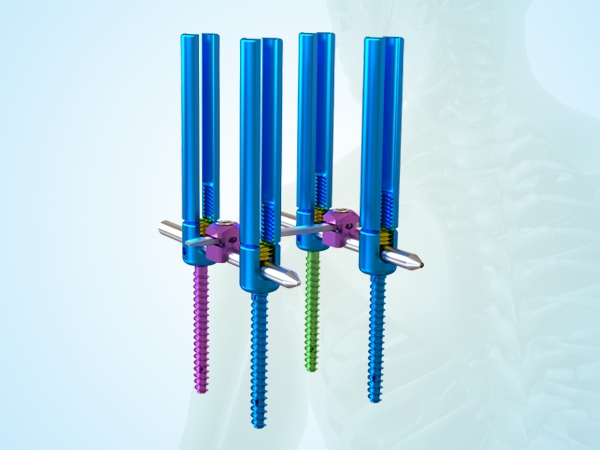 Minimally invasive spinal internal fixation type Ⅰ